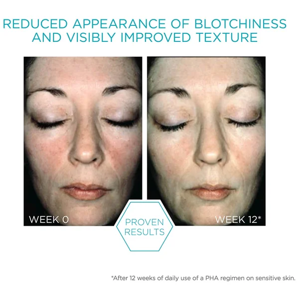 Neostrata Restore Bionic Face Cream For Dry, Sensitive Skin 40g 4 Neostrata Restore Bionic Face Cream For Dry, Sensitive Skin 40g - Image 2