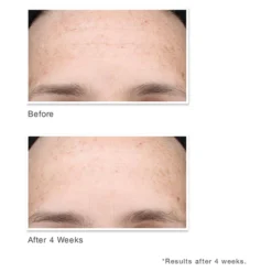 Murad Multi-Vitamin Infusion Oil 30ml 11 Murad Multi-Vitamin Infusion Oil 30ml -Wellagy Store 11706298 5354582829434056