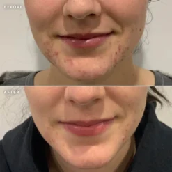 Alpha-H Clear Skin Tonic 100ml -Wellagy Store 12183424 1064939987422186