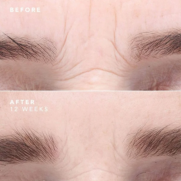 BIOEFFECT EGF Serum 15ml 7 BIOEFFECT EGF Serum 15ml - Image 5