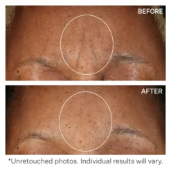 StriVectin SD Advanced PLUS Intensive Moisturising Concentrate 60ml -Wellagy Store 12528620 1234871310660006