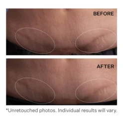 StriVectin SD Advanced PLUS Intensive Moisturising Concentrate 60ml -Wellagy Store 12528620 9964871310779997