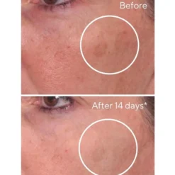 Murad Rapid Dark Spot Correcting Serum 30ml -Wellagy Store 12739129 1094898186604498