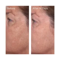 Murad Rapid Dark Spot Correcting Serum 30ml -Wellagy Store 12739129 1664830113317410