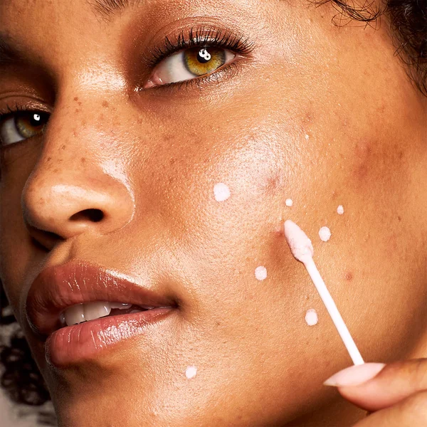 Kate Somerville EradiKate Blemish Treatment 30ml 6 Kate Somerville EradiKate Blemish Treatment 30ml - Image 4