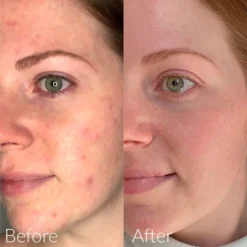 Caudalie Vinopure Blemish Control Salicylic Serum 30ml -Wellagy Store 13092208 7204880628784152