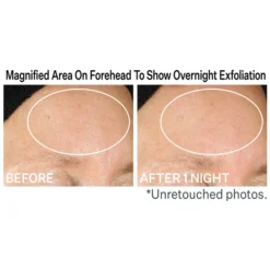 StriVectin Lactic Acid Nightly Retexturizing Serum 30ml -Wellagy Store 13103979 1234860882157200