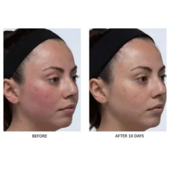 ALGENIST Blue Algae Vitamin C Skinclarity Brightening Serum 30ml -Wellagy Store 13222922 1404884709964790