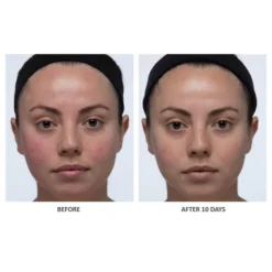 ALGENIST Blue Algae Vitamin C Skinclarity Brightening Serum 30ml -Wellagy Store 13222922 3574884710049945