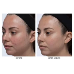 ALGENIST Blue Algae Vitamin C Skinclarity Brightening Serum 30ml -Wellagy Store 13222922 4204884710008845