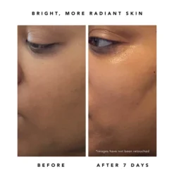 Herbivore Botanicals Nova 15% Vitamin C And Turmeric Brightening Serum 30ml -Wellagy Store 13508686 4814940998068534