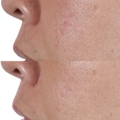 Perricone MD FG High Potency Face Finishing And Firming Toner 4 Oz -Wellagy Store 13658705 5905009464268730