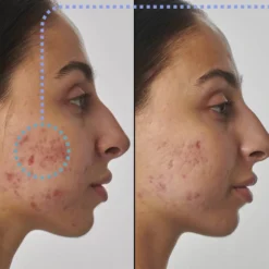 The INKEY List Super Solutions 1% Retinol Serum 30ml -Wellagy Store 14219139 5925030911191990